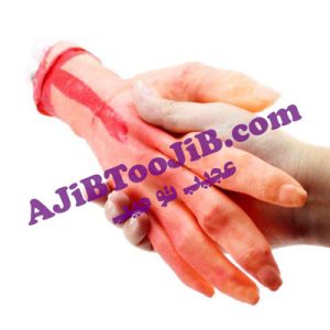 دست بریده خونی