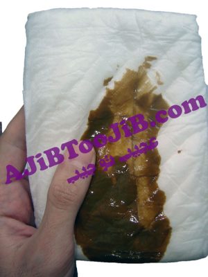 پوشک بچه کثیف