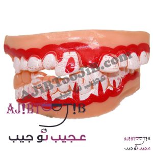 دندان و لثه دراکولا