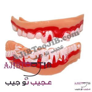 دندان و لثه دراکولا