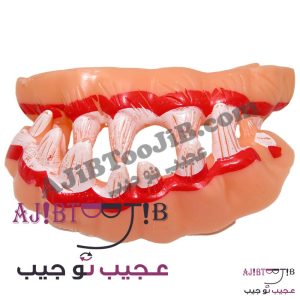 دندان و لثه دراکولا